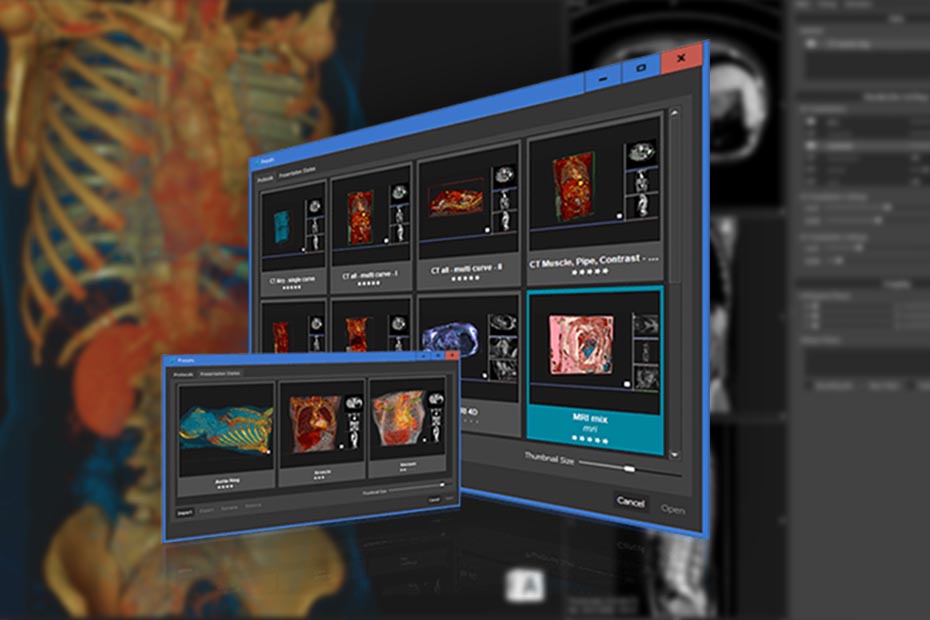 Vesalius3D states and standard visualizations