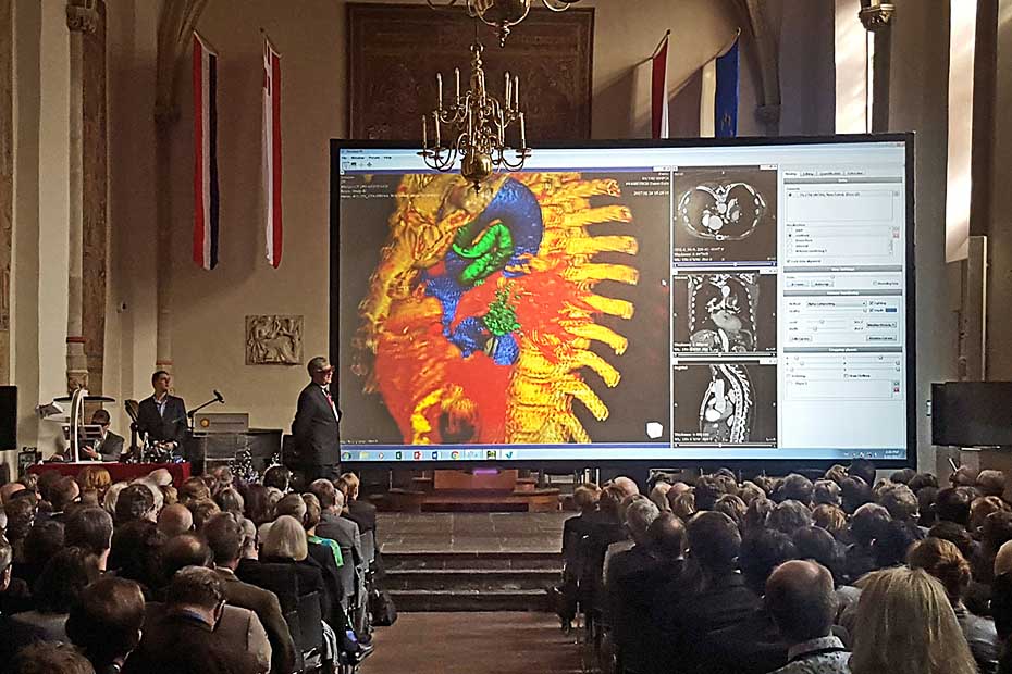Vesalius3D in a Stereo setting during a conference